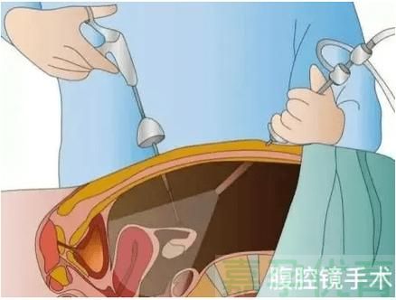 0107-5输卵管：生育路上的 “神秘通道”，你了解多少？.jpg