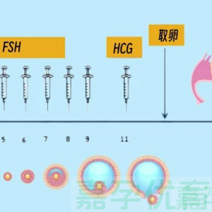 移植后保胎药怎么选？阿司匹林、肝素、黄体酮适用人群