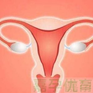 32 岁姑娘求子 2 年：卵巢差、输卵管堵、老公弱精，两次人