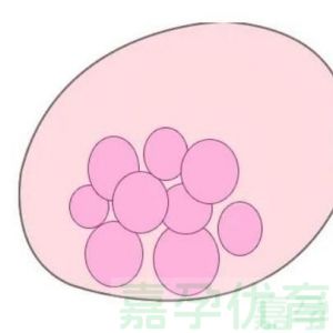 试管促排别只盯药量！卵泡监测才是关键，这些细节错了会影响取卵