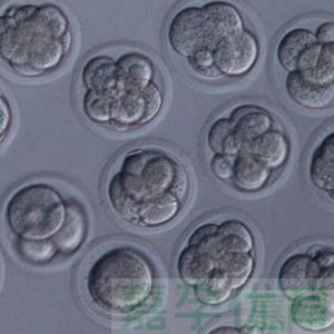 移植了优质胚胎，咋还会胎停育？这 6 个原因得弄明白​