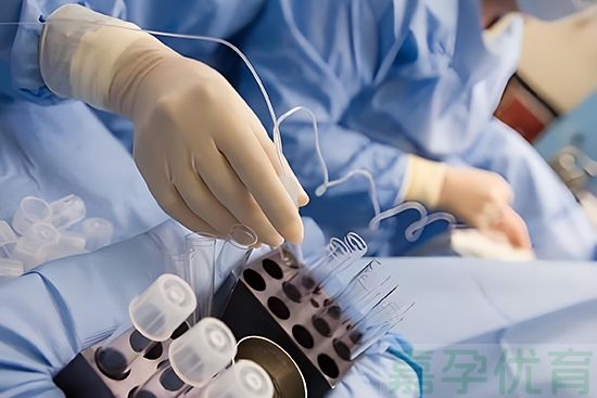 孕前取卵(图1) 孕前取卵(图1)